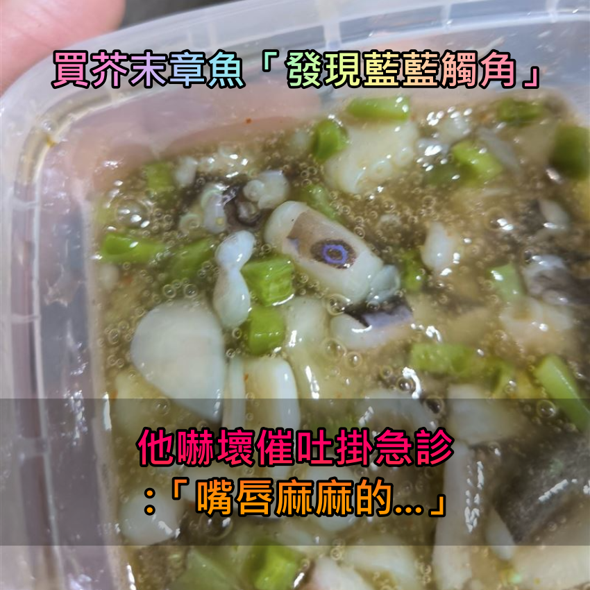 差一點就沒命！買芥末章魚吃「發現藍藍觸角」　他嚇瘋催吐「醫生竟喊沒解藥」　