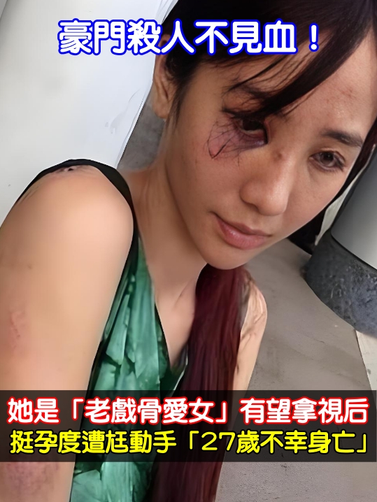 豪門殺人不見血！她是「老戲骨愛女」有望拿視后　挺孕度遭尪動手「27歲香消玉殞」
