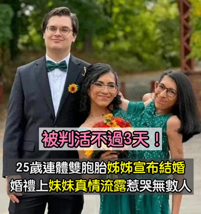 曾被判活不過3天！25歲連體雙胞胎「姊姊宣布結婚」　婚禮上「妹妹的真情流露」讓無數人落淚
