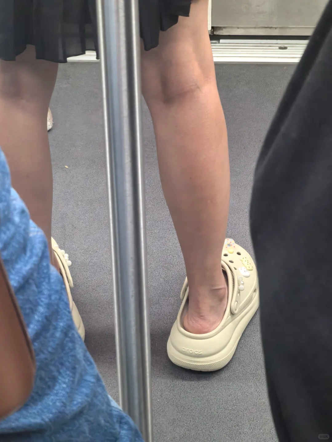 一堆人穿上街！她愛穿1鞋「竟害腳底長石頭」　醫生檢查搖頭：「都鈣化了...」