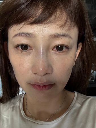 嫁議員尪9年！台語女歌手驚傳「臉部爆血送醫」　認了是他害的「床上血跡斑斑」