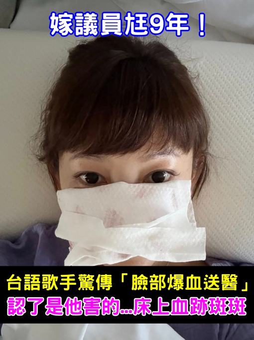 嫁議員尪9年！台語女歌手驚傳「臉部爆血送醫」　認了是他害的「床上血跡斑斑」