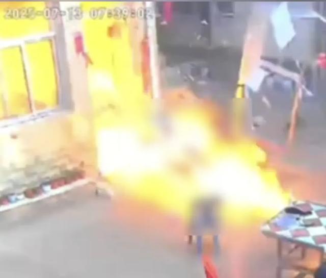 做飯時突爆炸！6歲女兒「在門口被沖飛」全身通紅　「母女嚴重燒傷」現況曝光：仍徘徊鬼門關