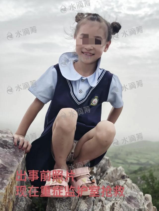 做飯時突爆炸！6歲女兒「在門口被沖飛」全身通紅　「母女嚴重燒傷」現況曝光：仍徘徊鬼門關