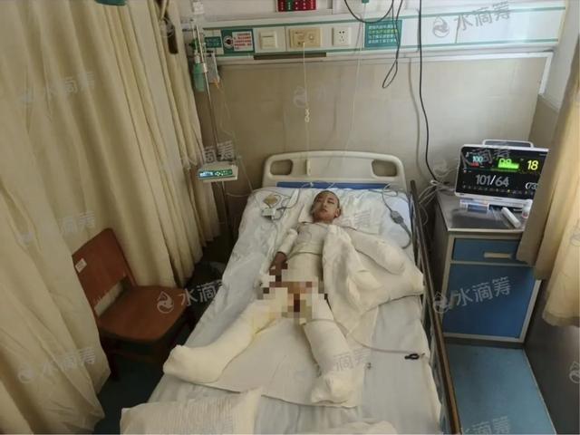 做飯時突爆炸！6歲女兒「在門口被沖飛」全身通紅　「母女嚴重燒傷」現況曝光：仍徘徊鬼門關