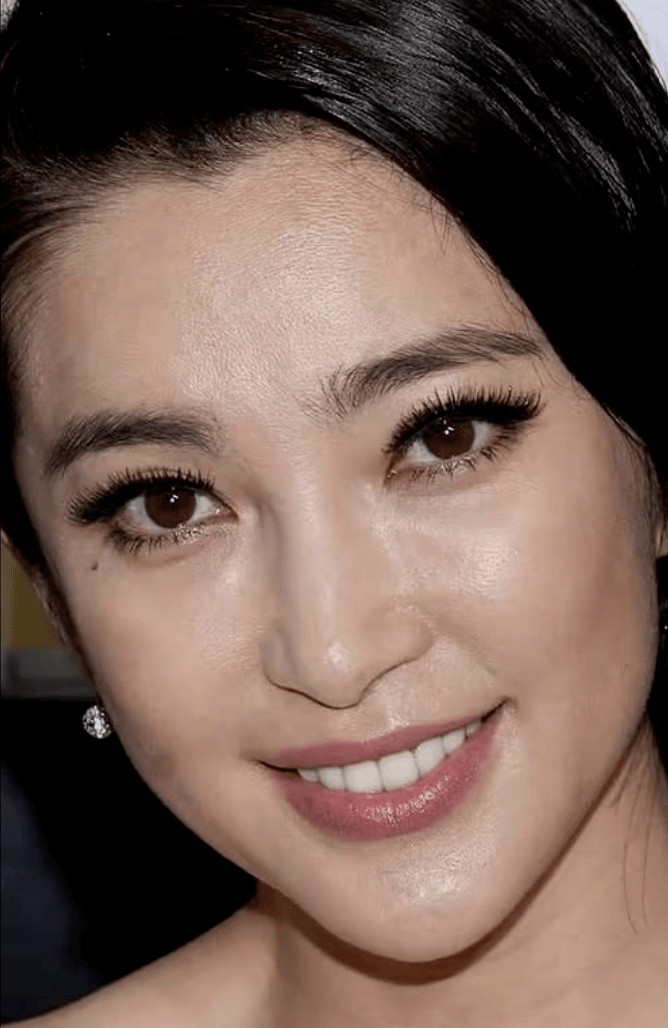 取出假體、溶掉玻尿酸！51歲女星「告別醫美」接納真實的自己　放棄凍齡「現況曝光」：太勇敢了