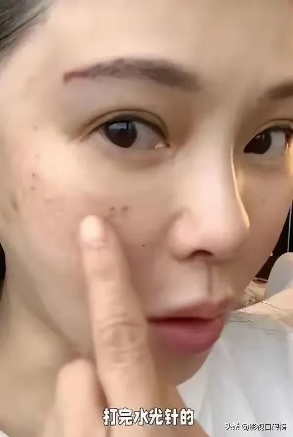 為凍齡每年花幾百萬！台灣不老女神「法國旅遊被偶遇」　浮腫素顏照流出遭酸「濃濃醫美痕跡」