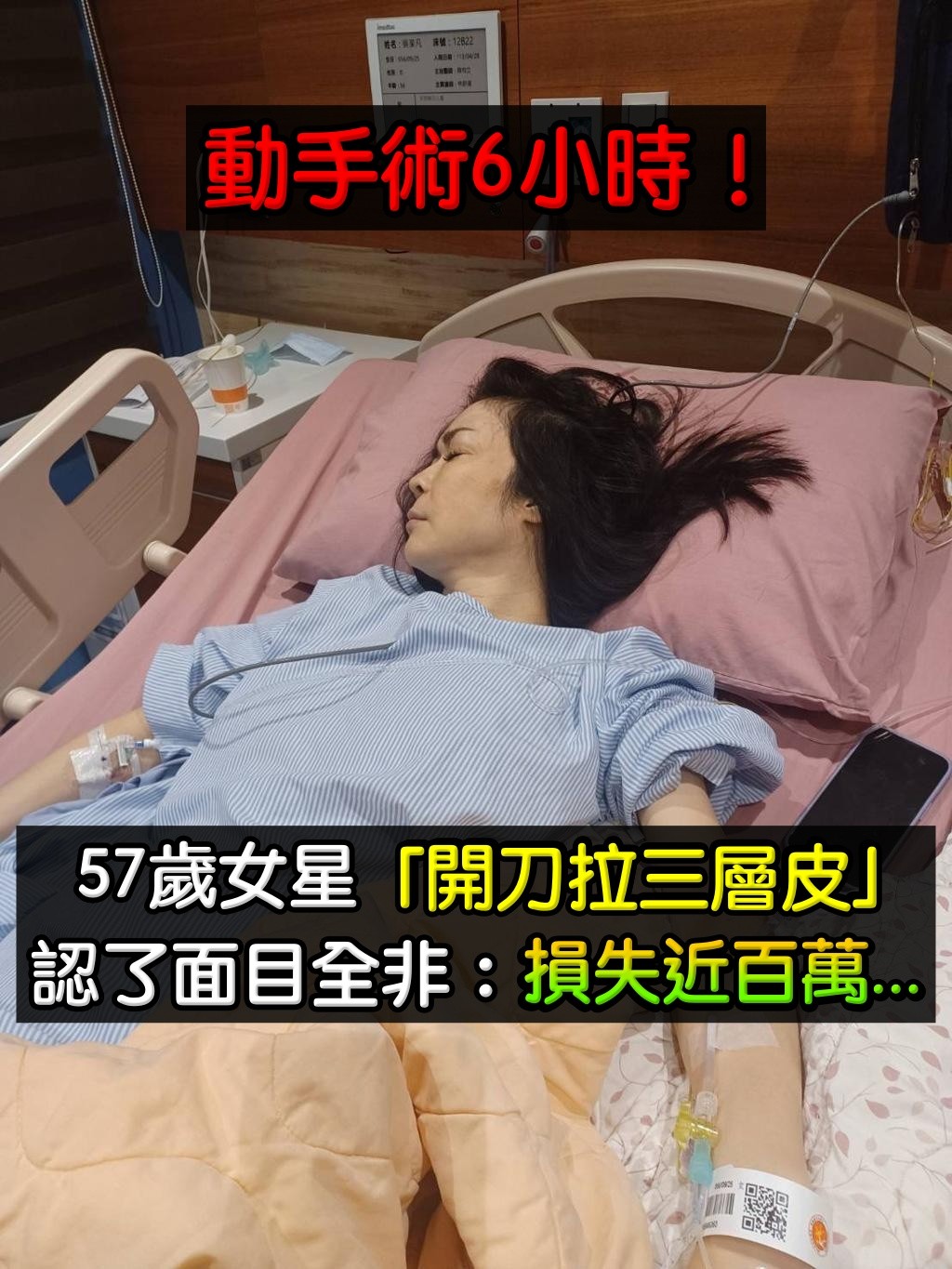 苦認面目全非！58歲女星「動手術六小時」拉三層皮　崩潰「遮全臉現身」嘆：已損失近百萬