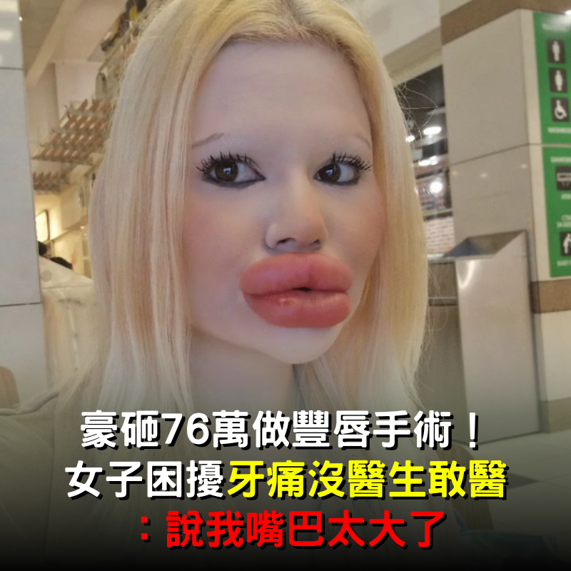 豪砸76萬做豐唇手術！女子困擾「牙痛卻沒醫生敢醫」：說我嘴巴太大了