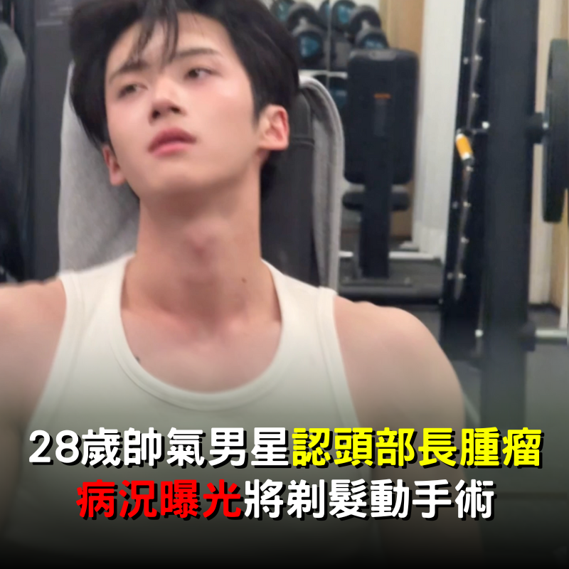 28歲帥氣男星認「腦部長腫瘤」！將剃髮動手術「病況曝光」