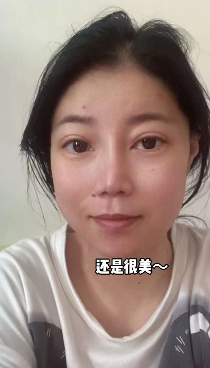 透析4年！校花歌手「未婚未育去世」年僅34歲　生前「拒絕媽媽換腎」哭了：別步我後塵