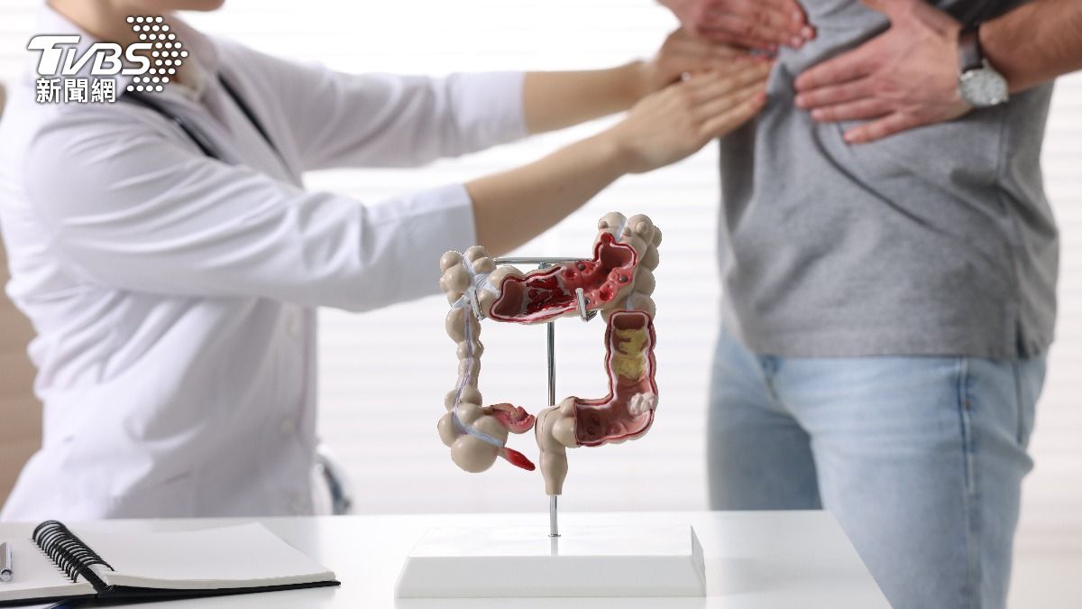 術後惡化到四期！腸癌患者「拒吃青菜」仍有奇蹟　醫生揭關鍵「每天吃半碗它」：2年半未復發