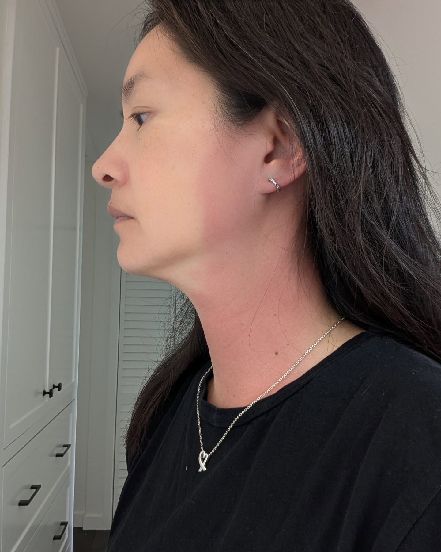 45歲Janet罹怪病！驚傳「高燒飆破40度」脖子全紅腫　查不出病因「改做一事」：症狀全消失