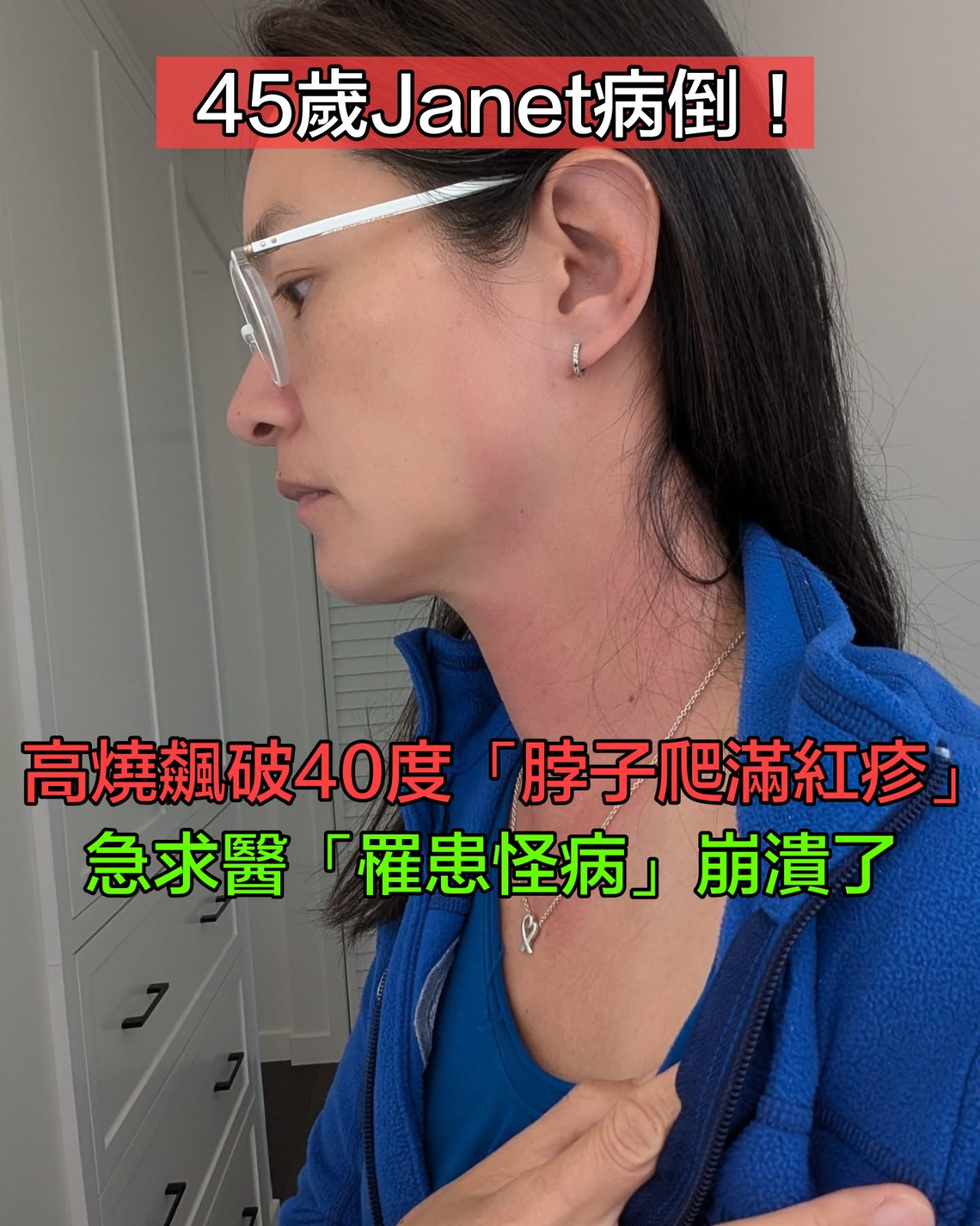 45歲Janet罹怪病！驚傳「高燒飆破40度」脖子全紅腫　查不出病因「改做一事」：症狀全消失