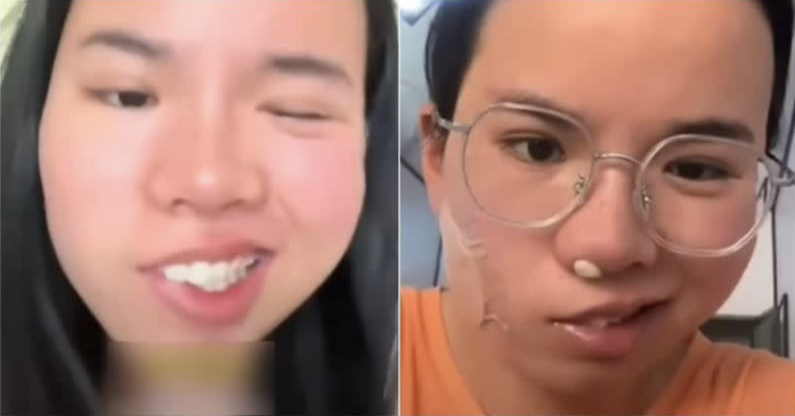 男子睡醒竟中風急送醫！醫生一看「睡覺這壞習慣」直搖頭：夏天不要這樣做