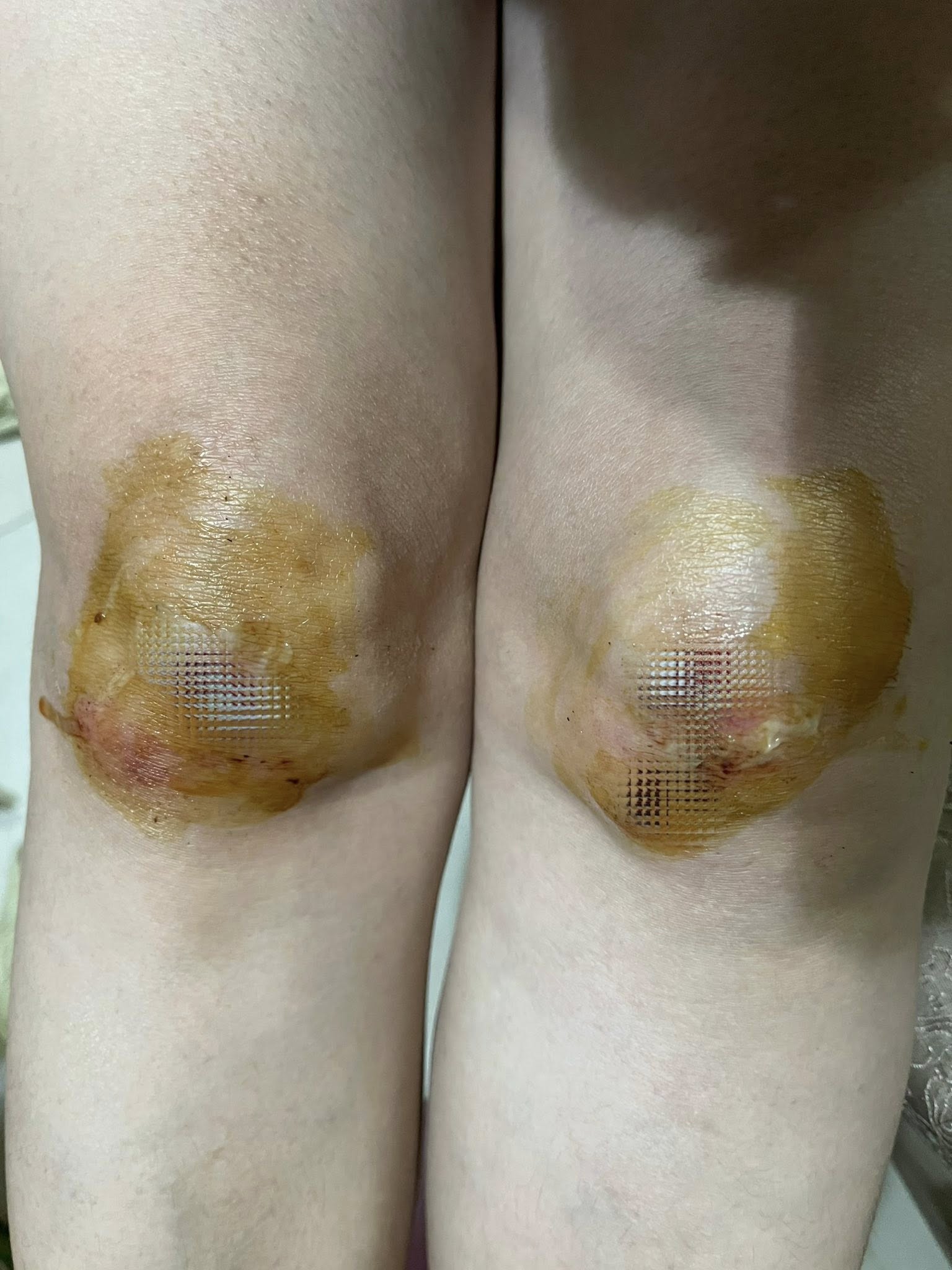 57歲本土女星出事！曝「膝蓋跪地重摔」吃止痛藥硬撐　堅持上工「敬業畫面流出」喊：過運過運
