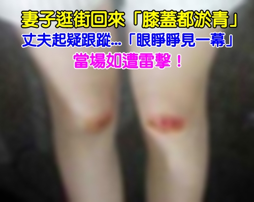 妻子出去逛街回來膝蓋就有淤青，老公起疑跟蹤，如遭雷擊！