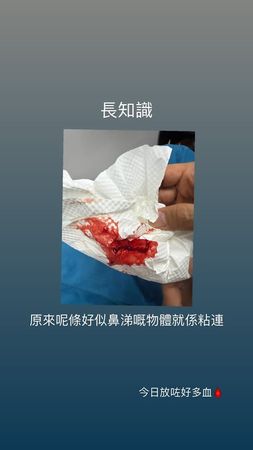 勇奪三大獎！37歲天后「突曬爆血照」抽出一條異物　嘆「慶祝還有生命」現況曝光