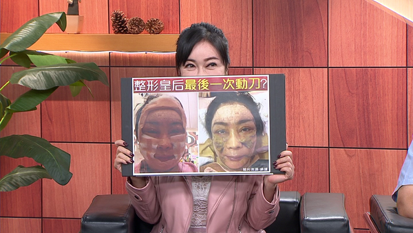 才罹大腸癌4期！58歲台灣美魔女星「再動6小時大手術」　樂觀喊「我是婦女同胞典範」：不能醜