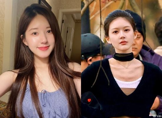 劇組病倒送醫！當紅女星「失語、重度憂鬱」剩37kg　揭真相「公司騙走800萬」宣戰：我不幹了