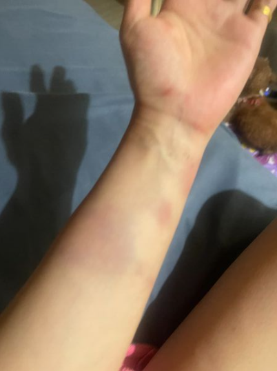 拒檢逃逸撞警！鄉土女星委屈哭了「出面解釋是誤會」　全身是傷 「確定告警察」：他賠不完