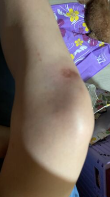 拒檢逃逸撞警！鄉土女星委屈哭了「出面解釋是誤會」　全身是傷 「確定告警察」：他賠不完