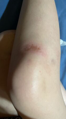 拒檢逃逸撞警！鄉土女星委屈哭了「出面解釋是誤會」　全身是傷 「確定告警察」：他賠不完