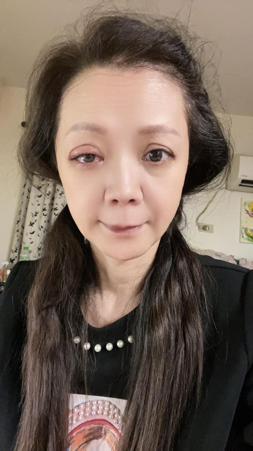 八點檔女星出事！凌晨爆意外「被尪緊急送醫」　不斷痛苦呻吟「最新病況曝」