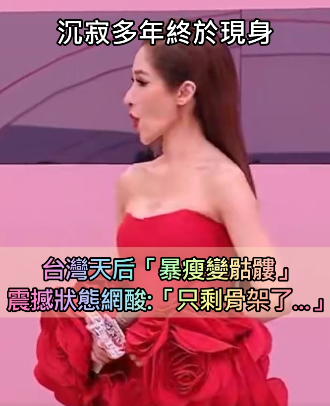 一年動刀4次！台灣天后沉寂多年「再現身瘦成骷髏」　震撼狀態曝光「網酸只剩骨架」：太可怕了...