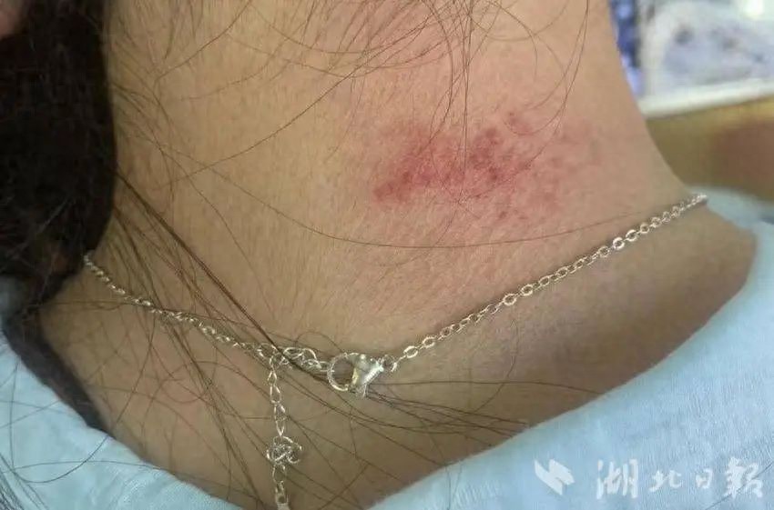 不要再買了！愛美人士超愛買小物「竟是一級致癌物」　人體無法代謝「送驗竟超標1000倍」