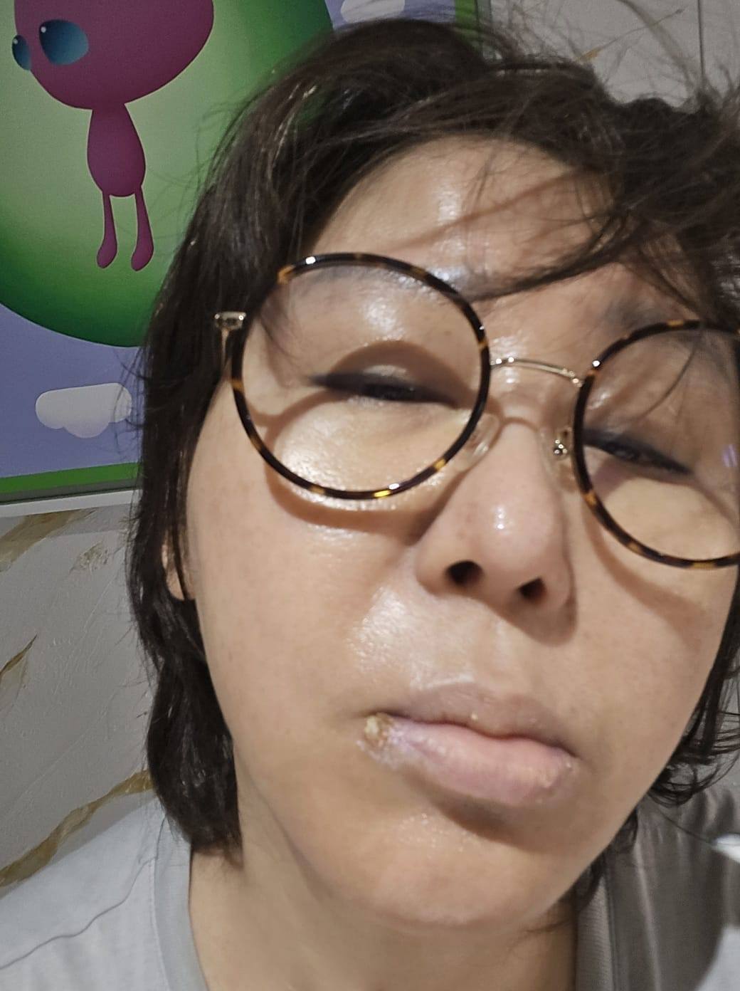 健康亮紅燈！藍心湄「嘴角長怪東西」憔悴素顏照曝光　網一看勸「快去看醫生」：別太拚...