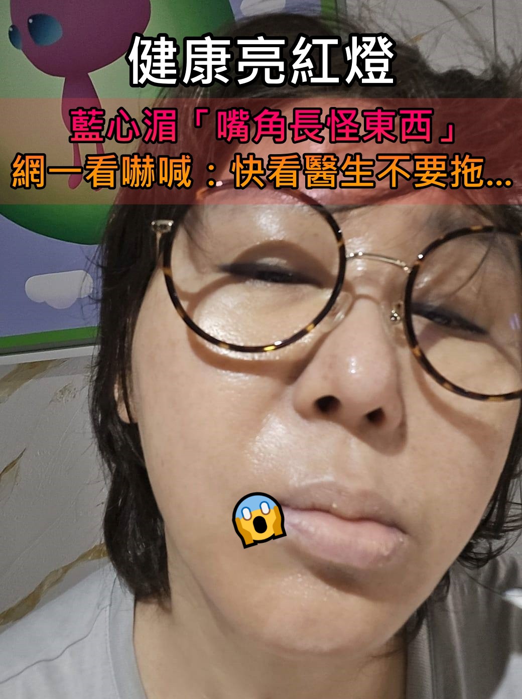 健康亮紅燈！藍心湄「嘴角長怪東西」憔悴素顏照曝光　網一看勸「快去看醫生」：別太拚...