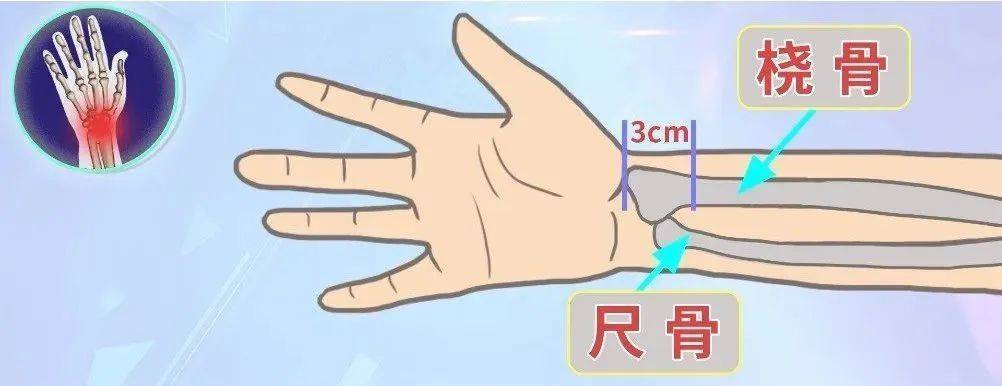 22歲男子摔倒以為沒事「7天後死亡」！摔到頭「這些信號」千萬別忽視