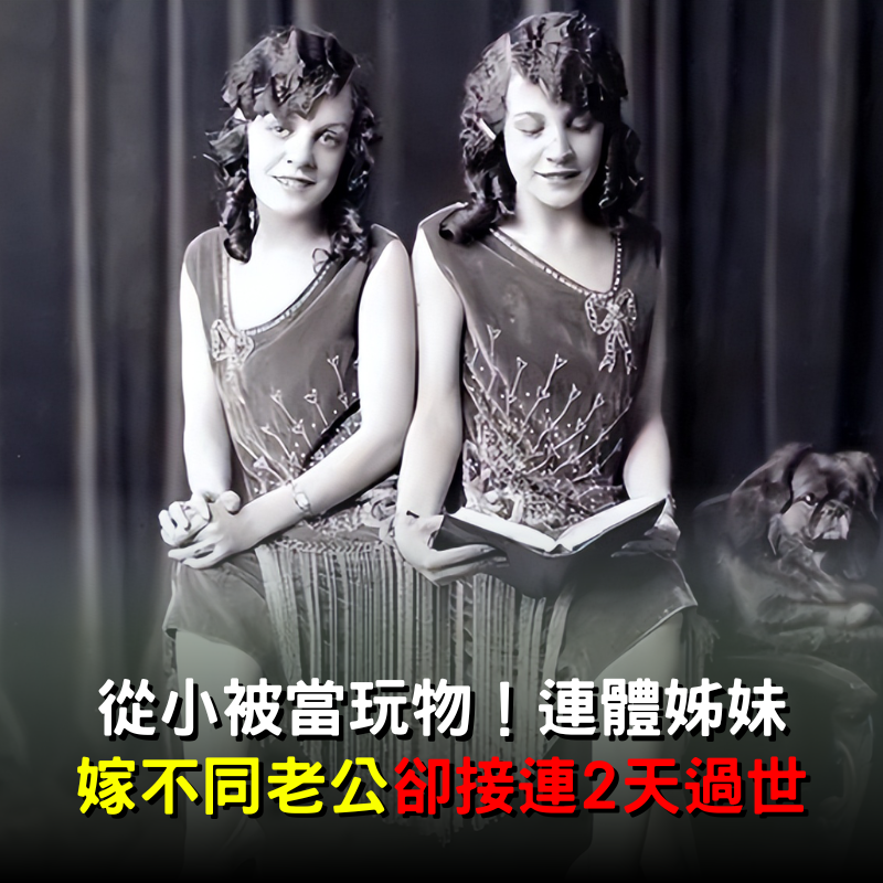 從小被當玩物！連體姊妹「嫁不同老公」卻接連2天過世　原因曝光