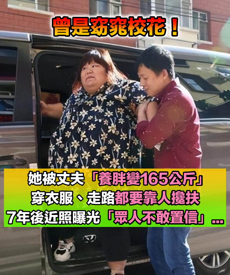 曾是窈窕校花！她被丈夫「養胖變165公斤」生活無法自理　7年後近照曝光「現況驚掉下巴」