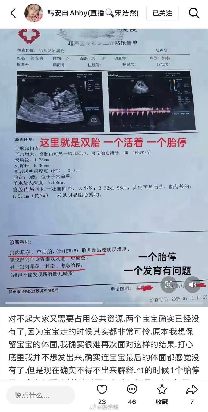 剛宣布懷上雙胞胎！百萬大咖「懷孕期間全麻整形」　本人悲痛證實「寶寶們沒了...」