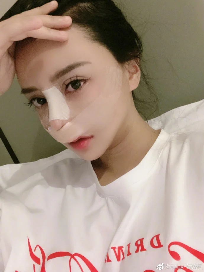 剛宣布懷上雙胞胎！百萬大咖「懷孕期間全麻整形」　本人悲痛證實「寶寶們沒了...」