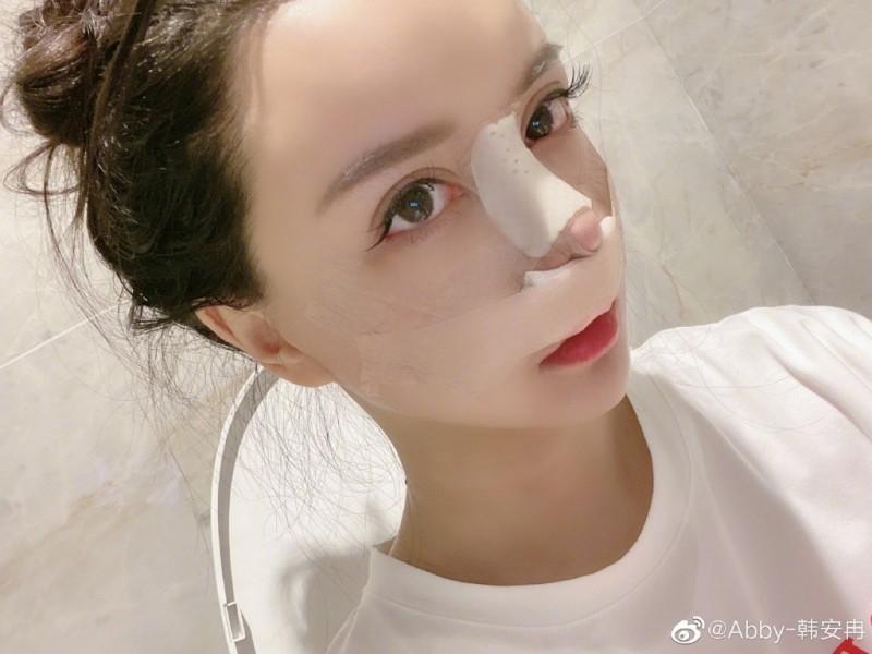 剛宣布懷上雙胞胎！百萬大咖「懷孕期間全麻整形」　本人悲痛證實「寶寶們沒了...」