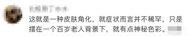 98歲老奶奶「頭上長怪角」自己拿剪刀剪掉！　大出血「送醫險命危」醫：長輩尤其要注意