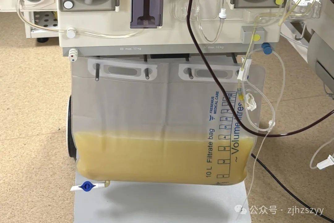 血液變牛奶色！40歲男喝酒後「被送進加護病房」　不聽醫生一事「小看這習慣」