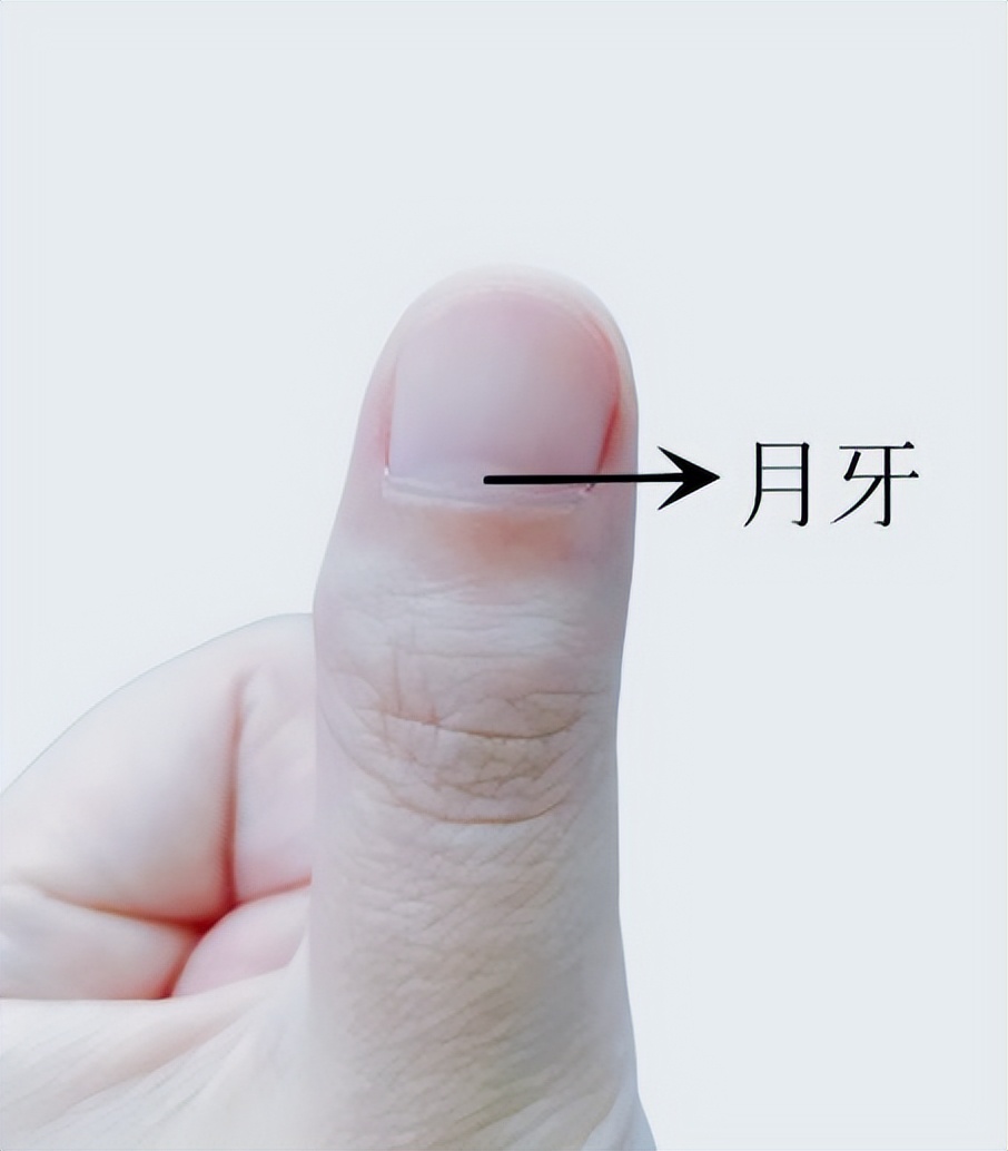 千萬要小心！指甲出現1變化，可能是癌變！
