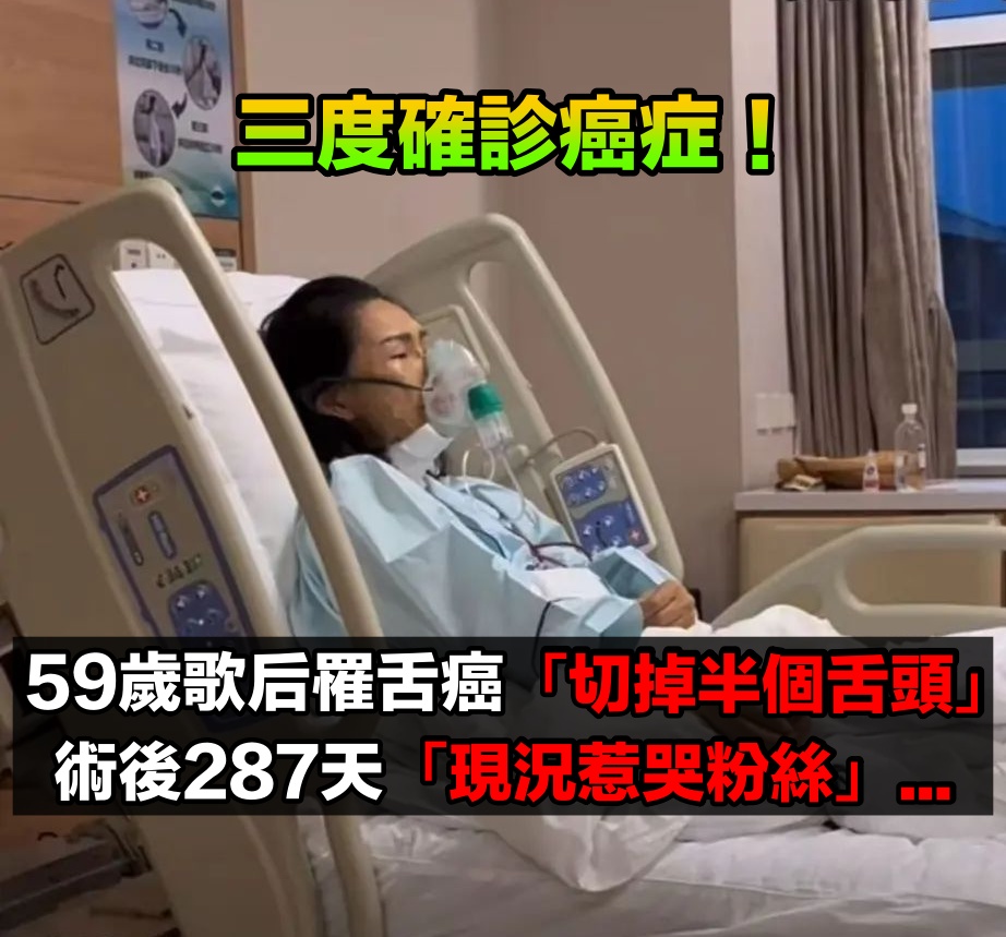三度確診癌症！59歲歌后罹舌癌「切掉半個舌頭」　術後287天「現況惹哭粉絲」：絕不會認輸...