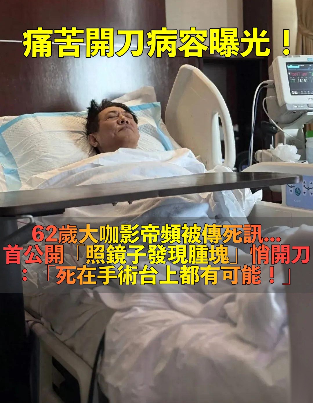 痛苦開刀畫面曝光！62歲影帝「照鏡子發現有腫塊」　首度公開病因：「手術台上走也有可能...」