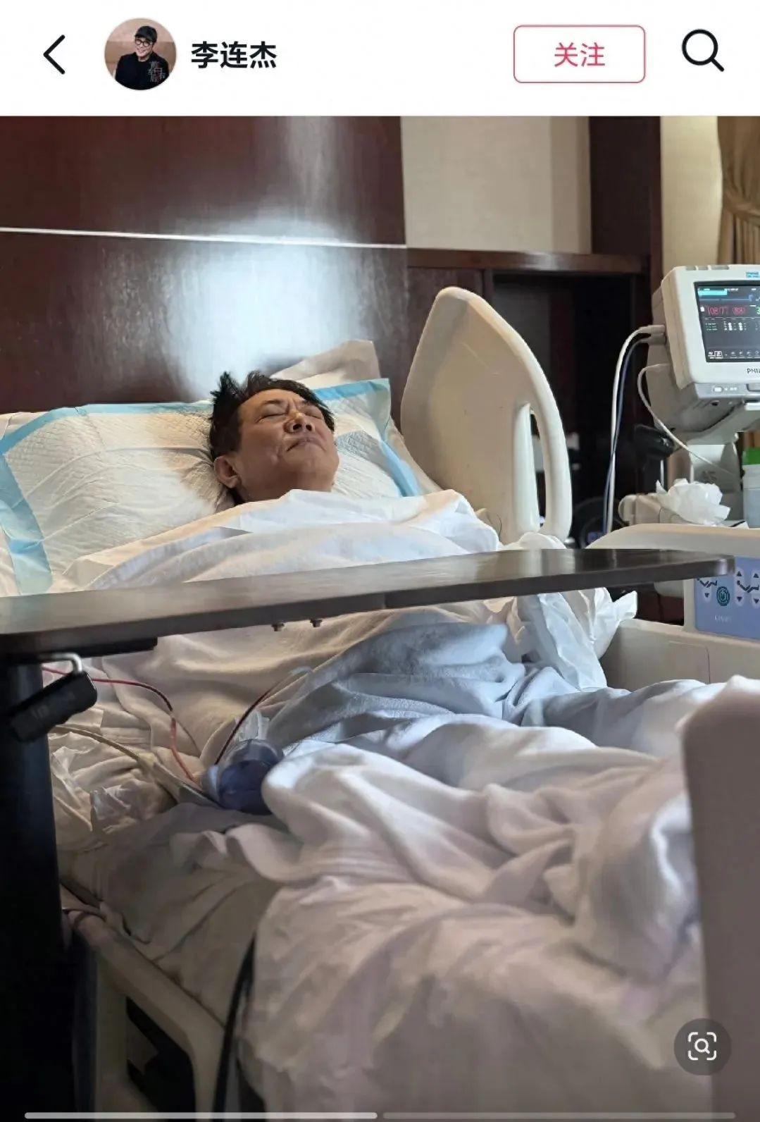 痛苦開刀畫面曝光！62歲影帝「照鏡子發現有腫塊」　首度公開病因：「手術台上走也有可能...」
