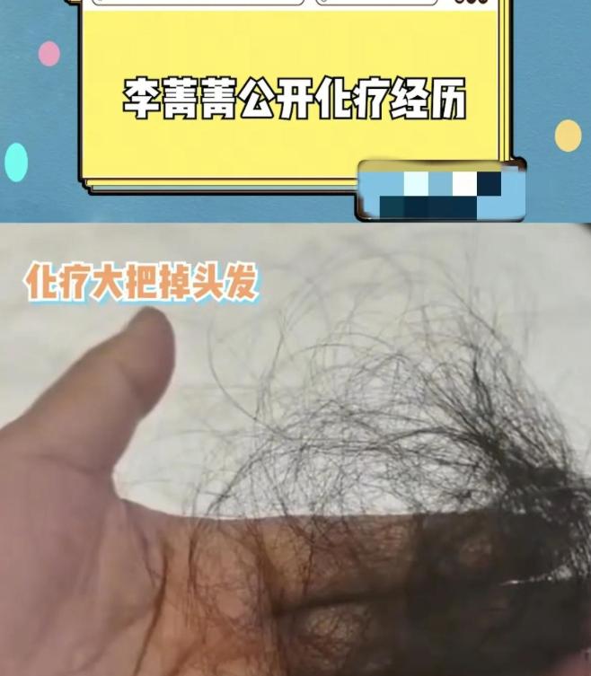 被500位導演封殺！資深女星「離婚3次、罹患乳腺癌」　生病瘦一大圈「近照差點認不出」 