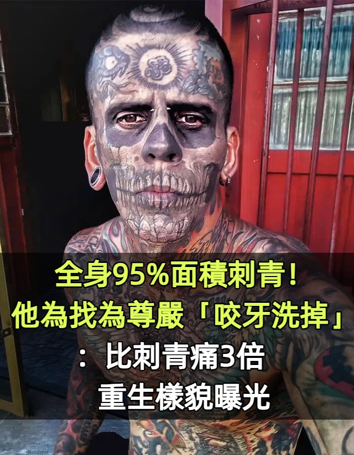 全身95%面積刺青！他為找為尊嚴「咬牙洗掉」：比刺青痛3倍　如今「重生樣貌曝光」