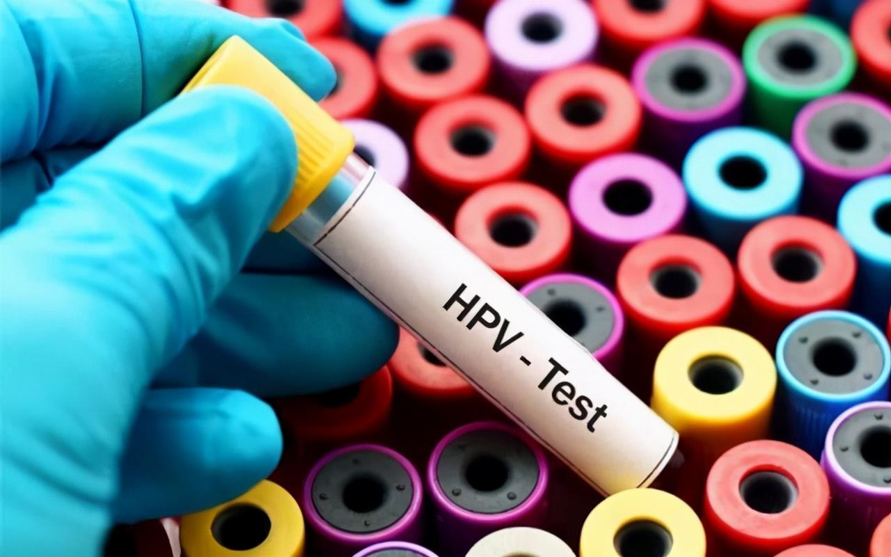 以為是過敏！生活規律夫妻卻「雙雙查出HPV」崩潰　醫生直言：5種行為是「幫凶」