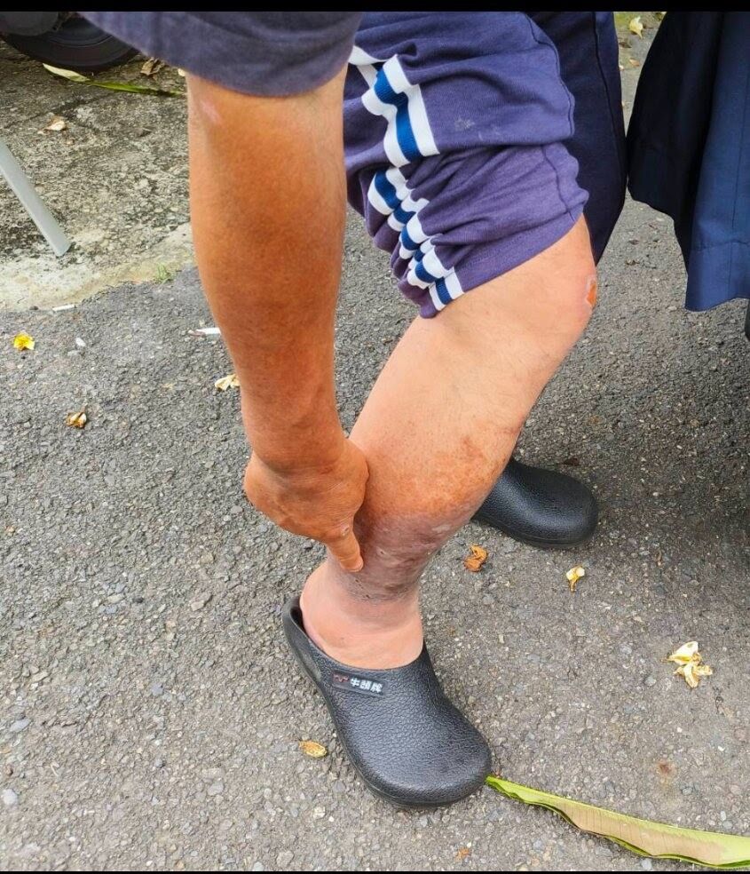 捨命救一家4口！台南勇警「雙腿詭異發黑」名醫搖頭　乩童驚喊：「你擋了抓交替」