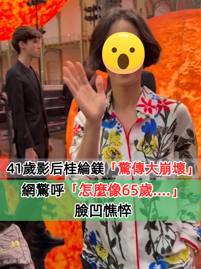 被封氣質影后！41歲桂綸鎂「驚傳大崩壞」　網驚呼「怎麼像65歲....」臉凹憔悴