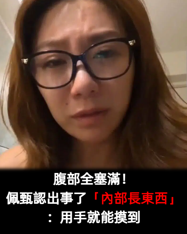 腹部全塞滿!佩甄工作壓力大「內部長東西了」:用手就能摸到